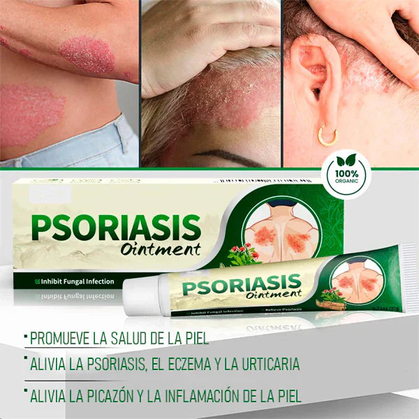 Crema Antifúngica y Antipicazón – Tratamiento Natural para Tiña, Hongos y Psoriasis | 20g