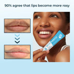 Belani-Fordyce® Despídete de las manchas en tus labios💋