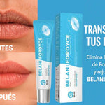 Belani-Fordyce® Despídete de las manchas en tus labios💋