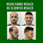 OFERTA 2x1 CRECE CABELLO 🌱✨REDUCTOR DE CAÍDA+ENVÍO GRATIS⭐