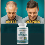 DHT BLOCKER 🌀 | Solución a la perdida de cabello!  ⏰